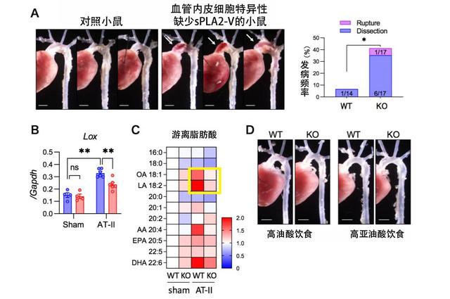 新研究揭示主动脉夹层发病分子机制